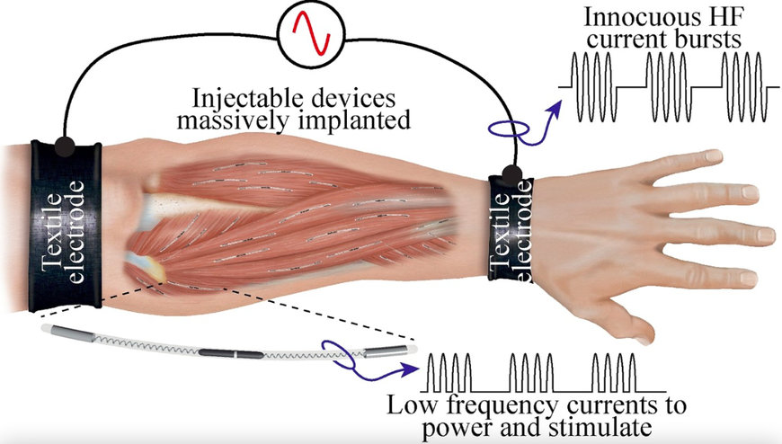 FRAUNHOFER DEVELOPS HUMAN-MACHINE INTERFACE THAT STOPS MUSCLE TREMORS